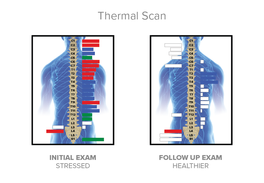Thermal scan at Proper Chiropractic